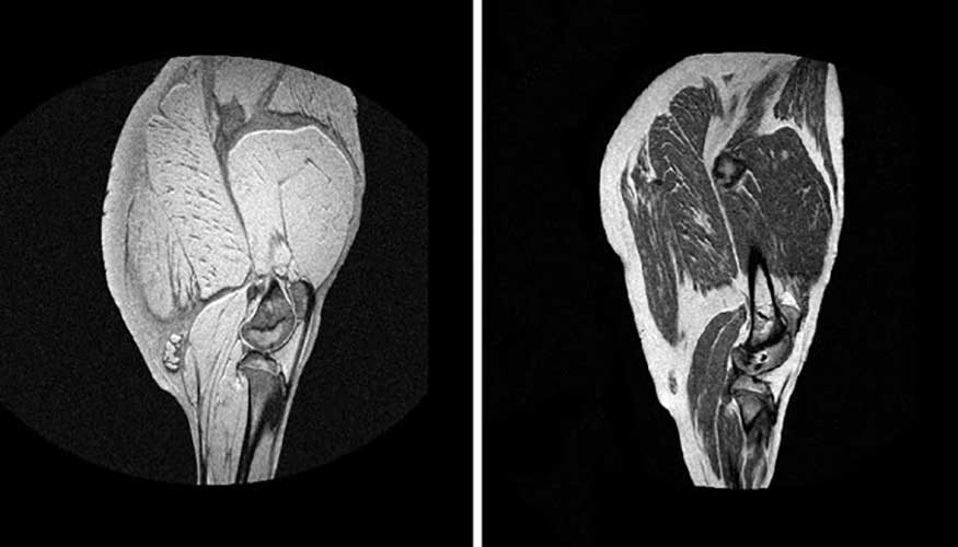 Imgenes de un jamn fresco y curado obtenidas con tecnologa MRI