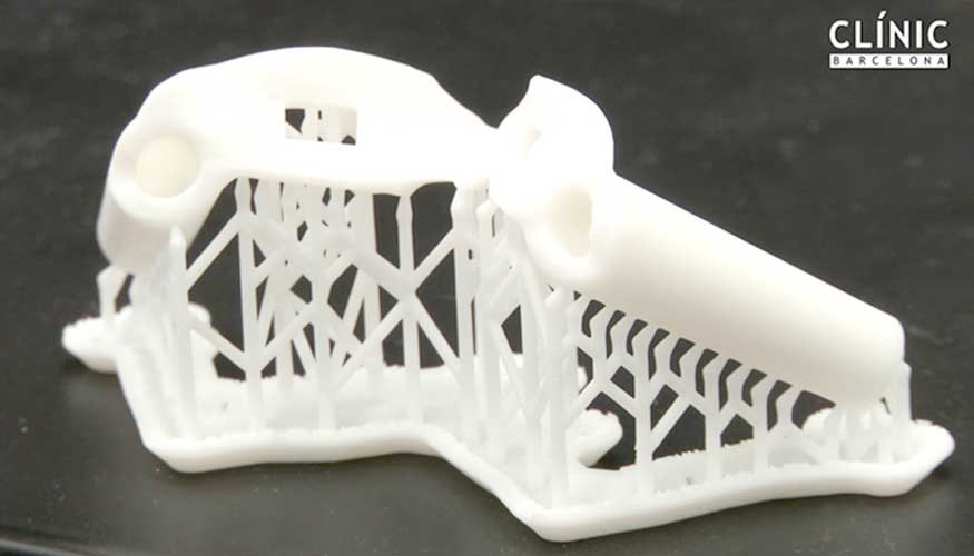 La nueva impresora 3D permite obtener piezas esterilizables de apoyo a la ciruga