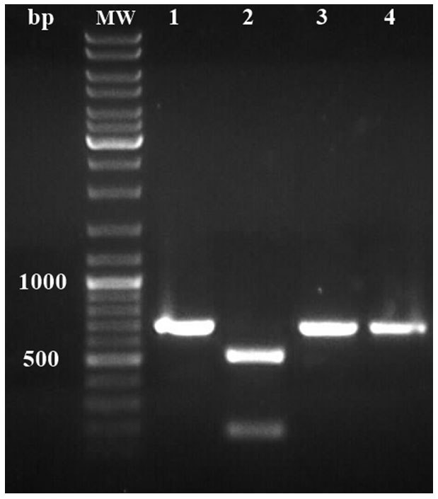 Figura 3: Anlisis de RFLP con KpnI de productos de RT-PCR generados con los cebadores que amplifican para la cpside...