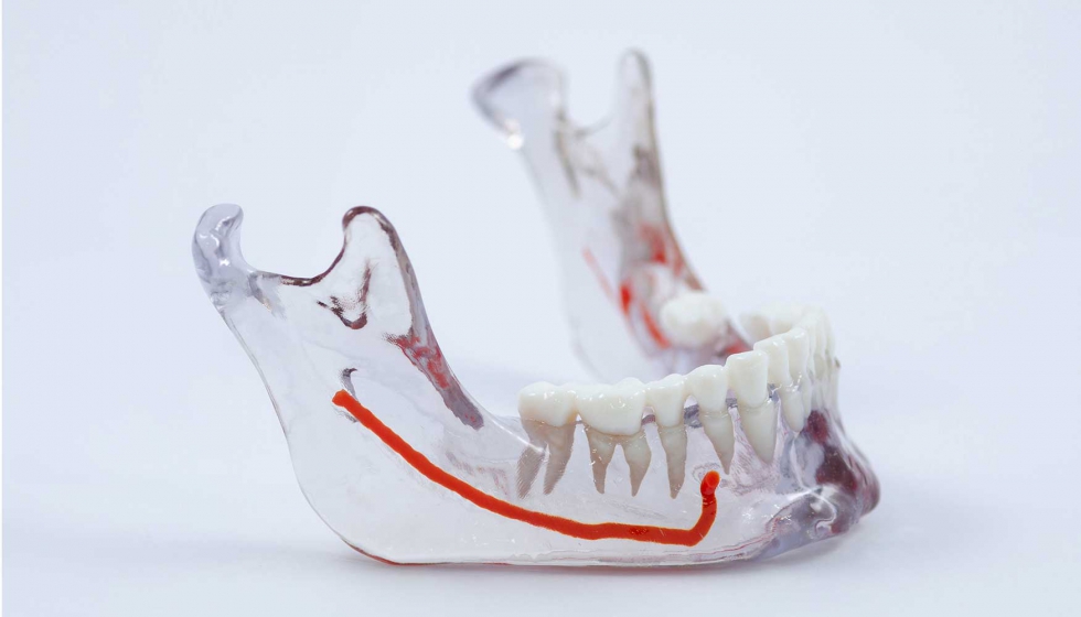 Modelo transparente complejo de la mandbula de un paciente, producido en diversos materiales y colores inyectados, todo con una sola impresora...