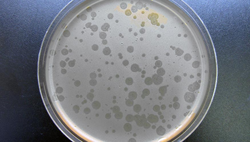 Placa con la bacteria Salmonella infectada por diferentes bacterigafos