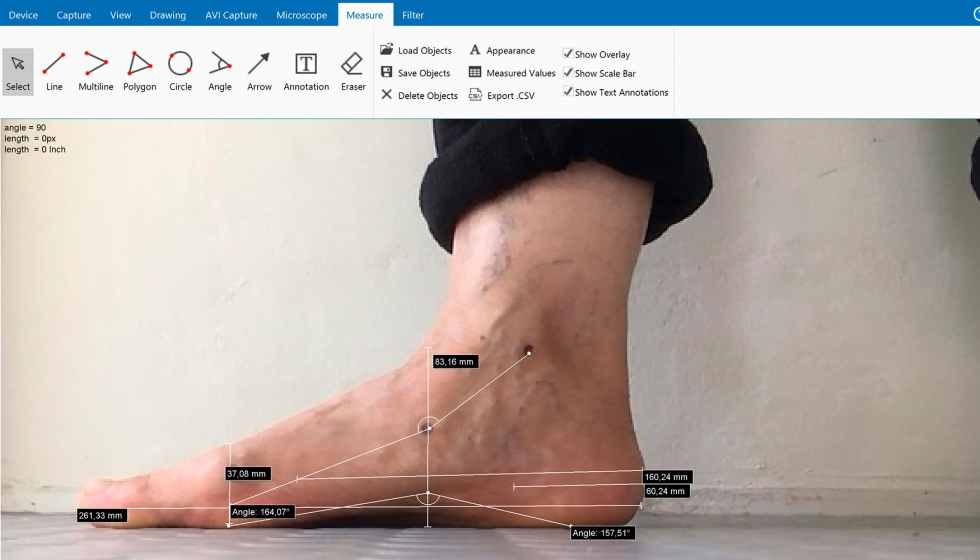 Utilizando informacin mdica proporcionada por el usuario y tomando algunas fotos de sus propios pies...