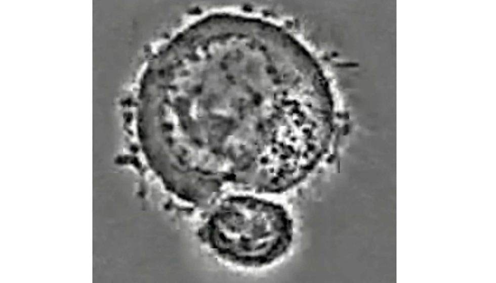 En la parte inferior de la imagen un linfocito citotxico que interacciona con una clula tumoral (la de mayor tamao)