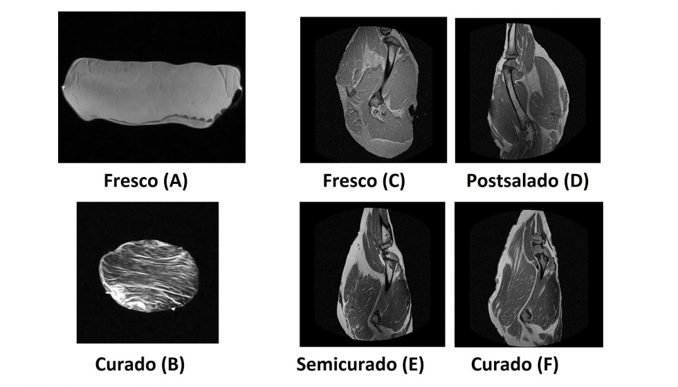 Figura 2: MRI de lomo (A y B) y de jamn ibricos (C, D, E y F)