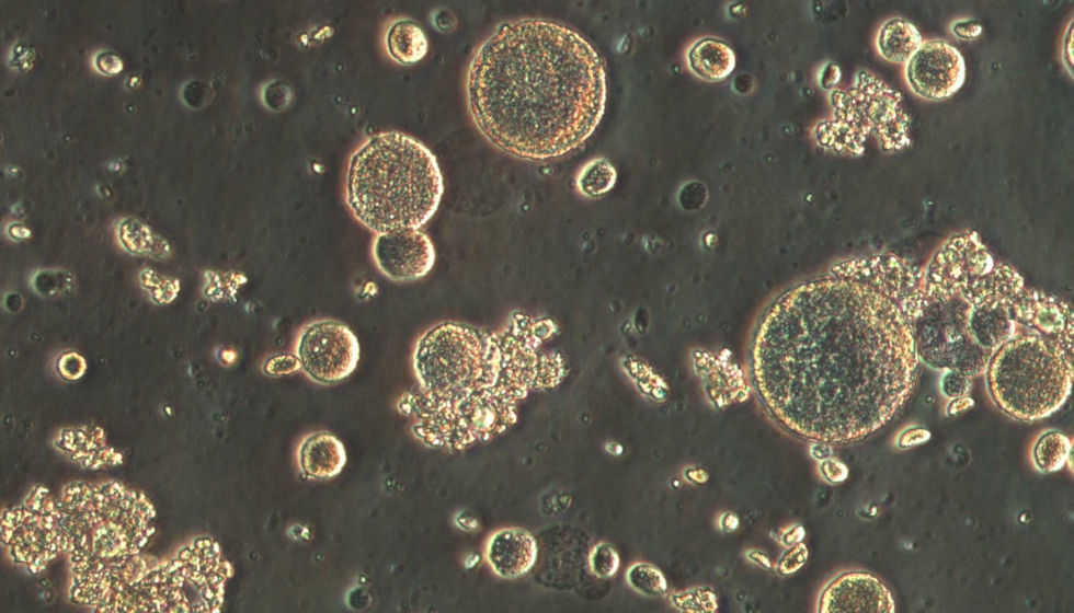 Imagen del microscopio ptico de las cpsulas