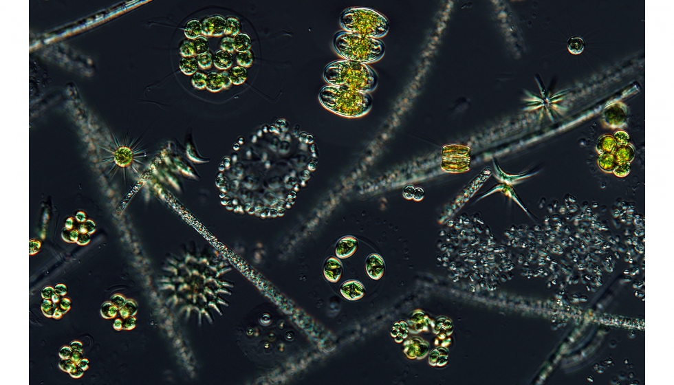 Figura 3. Microalgas hetertrofas. Petr Znachor, Institute of Hydrobiology, Biology Centre CAS