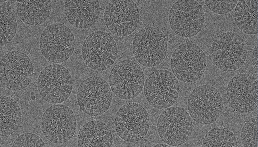 Imagen de virus (rotavirus) tomada con el criomicroscopio electrnico del CNB-CSIC