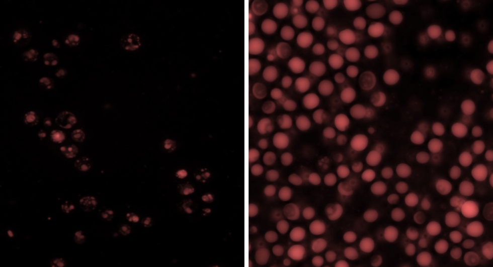 Figura 2. Microfotografas con tincin fluorescente en las que se observan microesferas vacas (izqda...