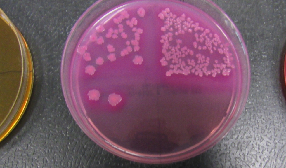 En el centro de la imagen, colonias de enterobacterias presentes en la vagina durante el estro