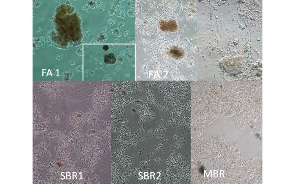 Figura 4: Aspecto microscpico para las muestras de EDARI estudiadas. In vivo. Contraste de fangos. 100x