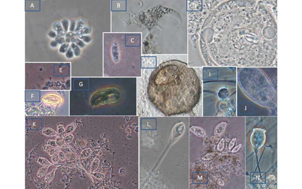 Figura 6: Distintos protistas encontrados en las muestras de EDARI estudiadas. In vivo