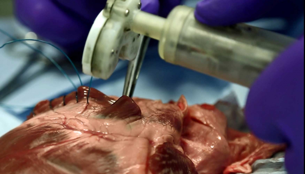 Automatismo para sutura de Sutrue (UK) en una operacin cardiaca. Foto: Sutrue
