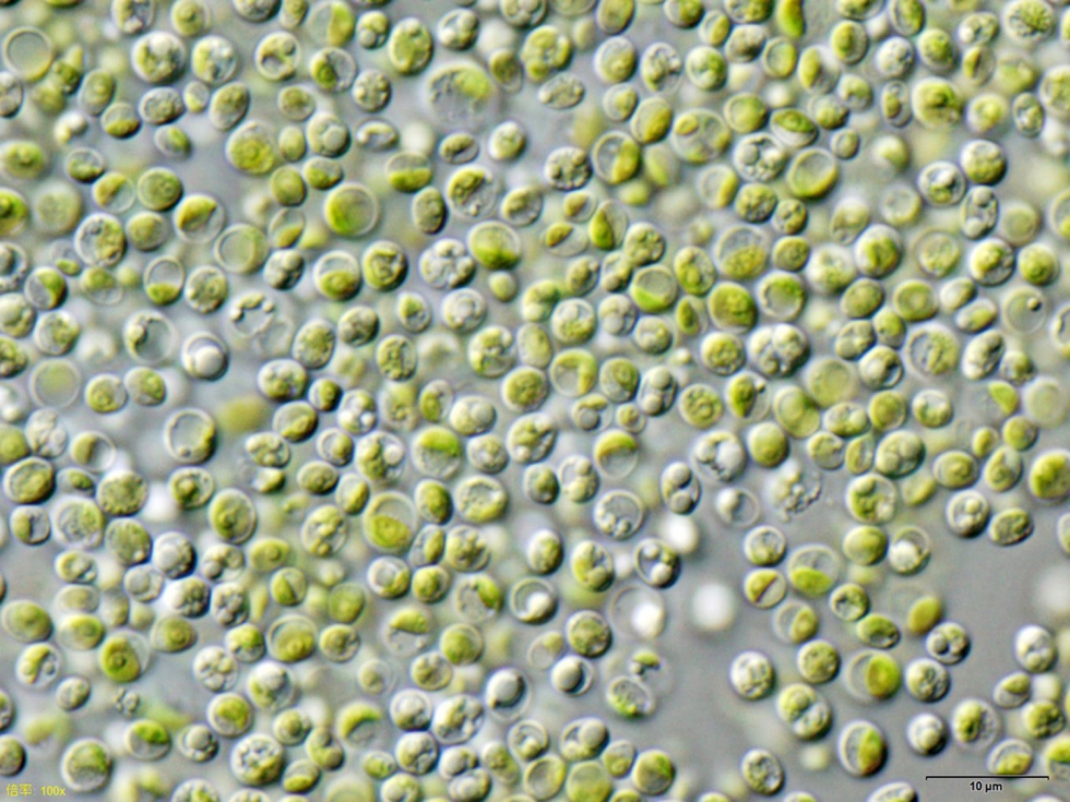 La Chlorella vulgaris es una de las microalgas que se estudiarn. Foto: NEON, licencia Creative Commons