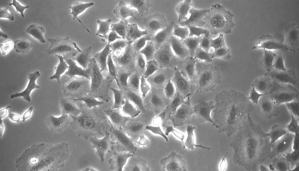 Clulas epiteliales de pulmn vistas al microscopio ptico / CIB-CSIC