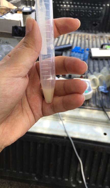 Muestra de semen