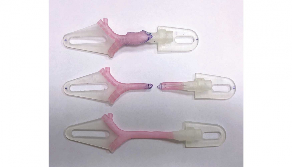 Modelos impresos en 3D que muestran la planificacin quirrgica virtual para un procedimiento de traqueoplastia...
