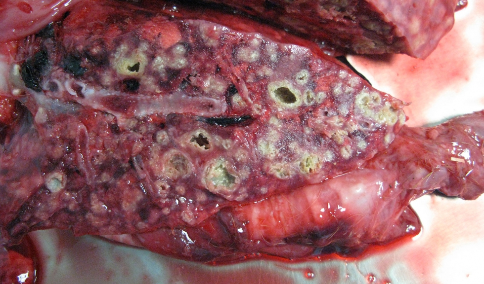 Lesiones t�picas de la tuberculosis