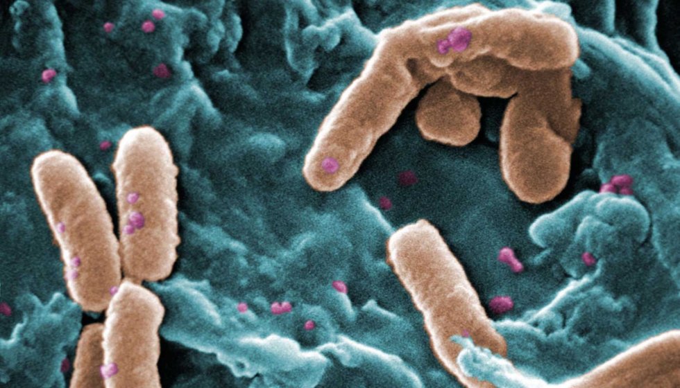 Microscopia electrnica de Pseudomonas aeruginosa