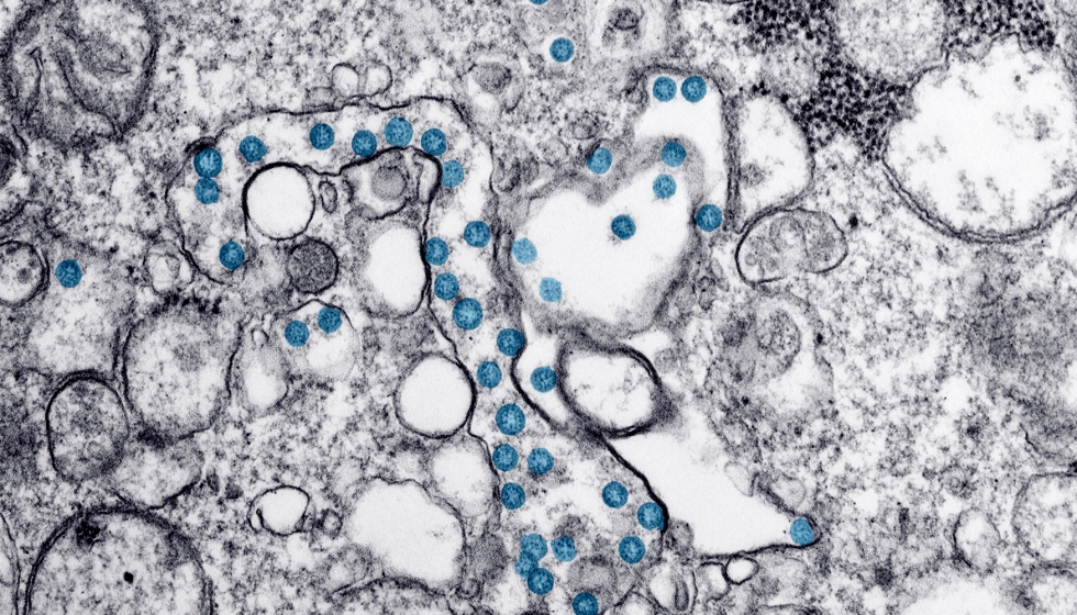Partculas del virus SARS-CoV-2, coloreadas en azul, en una imagen de microscopio de electrones. Foto: CDC