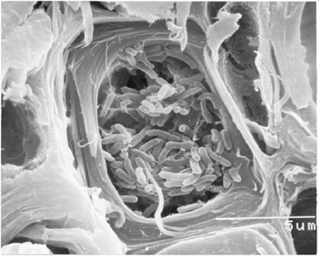 Fotografa de Xylella fastidiosa al microscopio electrnico de barrido. La barra blanca de escala corresponde a 5 micras (1/200 de milmetro)...