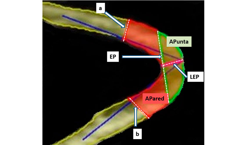 Figura 4. An�lisis de la ecograf�a