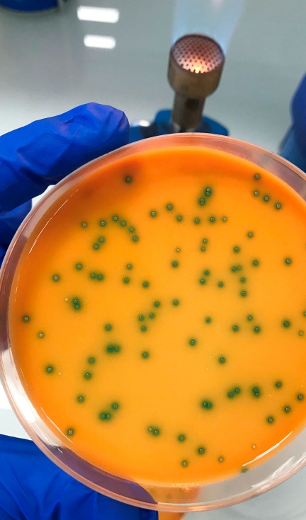 Colonias de �L. monocytogenes� en placas de medio RAPID'L.mono. Imagen: Grupo de Investigaci�n Pat�genos Intracelulares Biolog�a e Infecci�n...