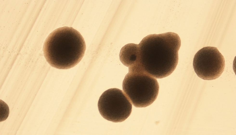 Imagen al microscopio de una colonia de Saccharomyces uvarum. Foto: Laura Prez Travs (IATA-CSIC)