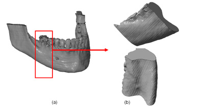 Figure 2. 3D CAD design of the jaw (a) jaw full; (b)Pieces of jaw to make (have been deleted the teeth)