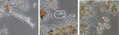 Figura 6: Distintos gneros de protistas, presentes en fangos activos con buenas calidades de depuracin
