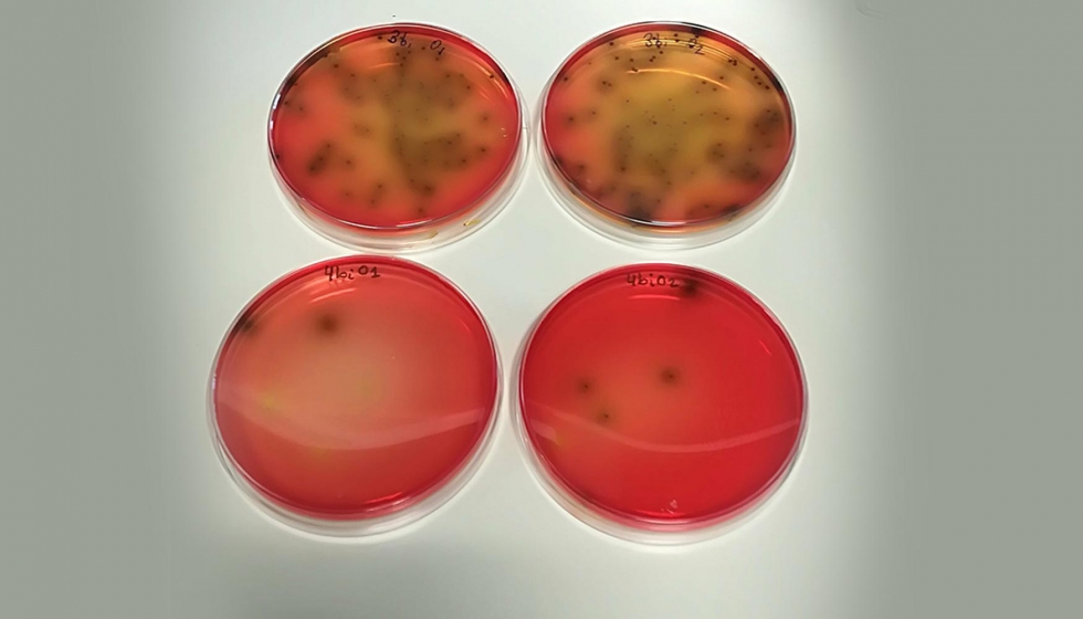 Bacterias patgenas de alimentos