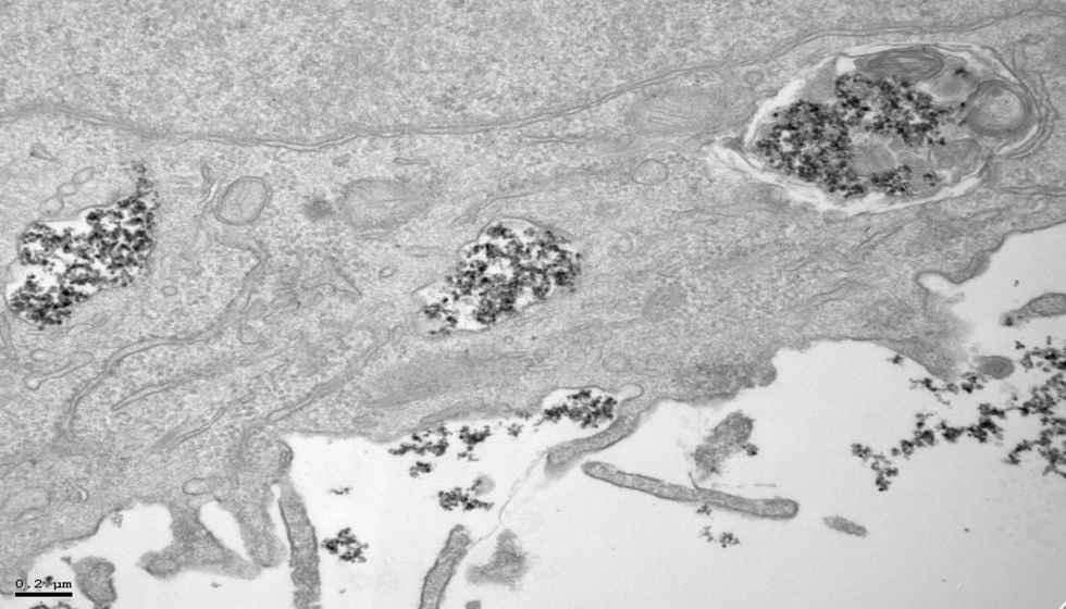 Nanopartculas de xido de hierro en el interior de vesculas celulares en una imagen tomada con un microscopio electrnico de transmisin (TEM)...
