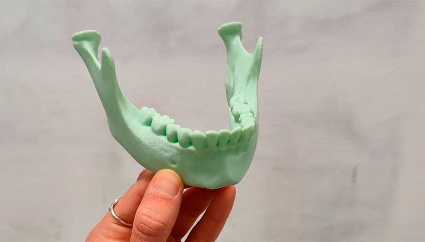 La maxilofacial ser uno de los tipos de ciruga que generar modelos impresos en 3D