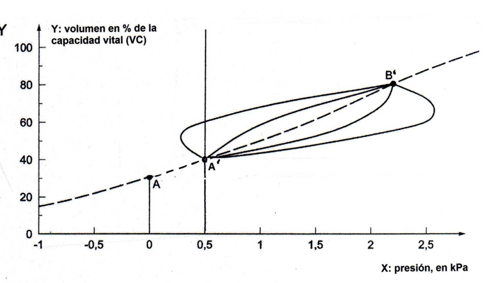 Figura 4: Volumen pulmonar versus presin usando un EPR con resistencia al paso del caudal de aire y presin esttica