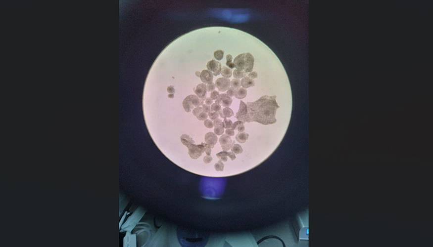 Ovocitos de matadero madurados �in vitro�