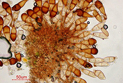 Micrografa de Puccinia graminis, el cual es el hongo que causa la roya del tallo del trigo. Foto cortesa de APHIS/USDA, Bugwood...