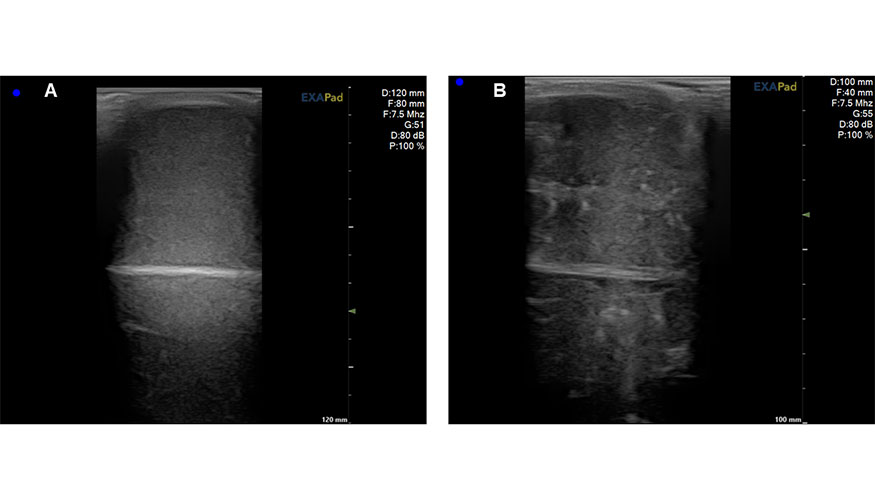 Figura 2. Im�genes ecogr�ficas de un corte longitudinal lateromedial de test�culo de semental ovino. A...