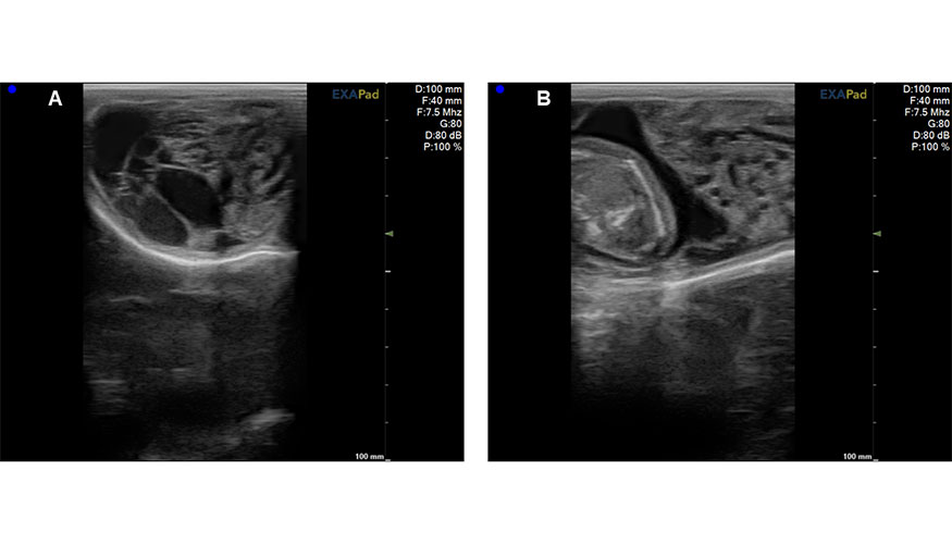 Figura 3. Im�genes ecogr�ficas en modo B de un corte transversal caudocraneal del cord�n esperm�tico de carnero. A...