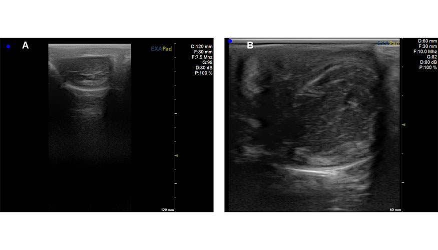 Figura 4. Im�genes ecogr�ficas en modo B de un corte transversal caudocraneal de la cola de epid�dimo del semental ovino. A...