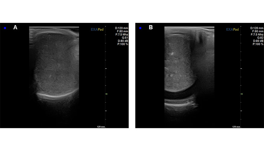 Figura 5. Im�genes ecogr�ficas en modo B de un corte transversal caudocraneal de test�culo de carnero. A...