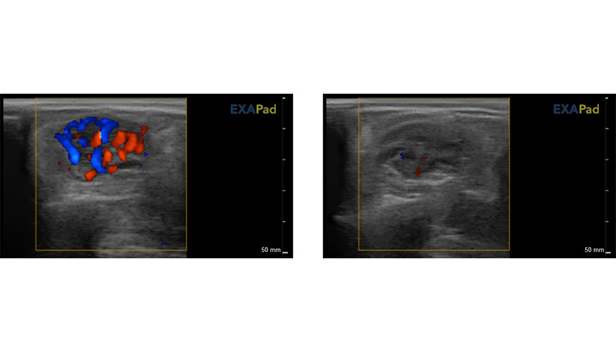 Figura 6. Im�genes ecogr�ficas en modo Doppler color del cord�n esperm�tico de un semental ovino. A...