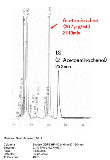 Figura 6: Anlisis directo de acetaminofeno en suero