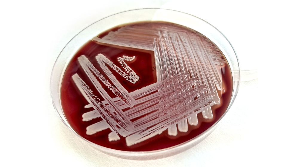Crecimiento de colonias de Staphylococcus spp. en el medio de cultivo Agar Sangre (AS)