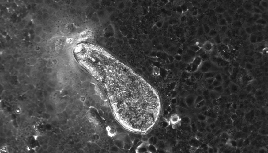 Imagen de microscopio del gusano parsito Fasciola hepatica
