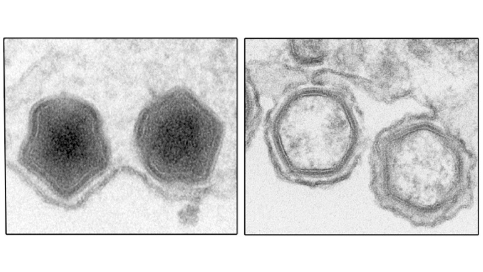 Micrografas electrnicas de partculas del virus de la peste porcina africana producidas en presencia (izqda.) y ausencia (dcha...