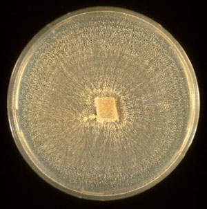 Foto 2: cepa mutante albina del hongo cromgeno. Obsrvese la ausencia de pigmentacin