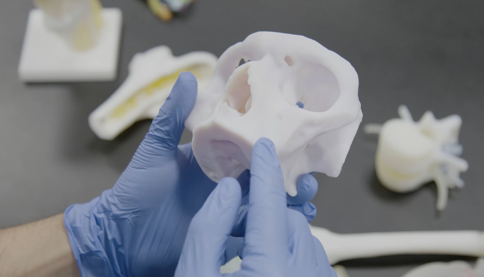 Los modelos anatmicos impresos en 3D son visualizaciones realistas y especficas de la anatoma de un paciente...