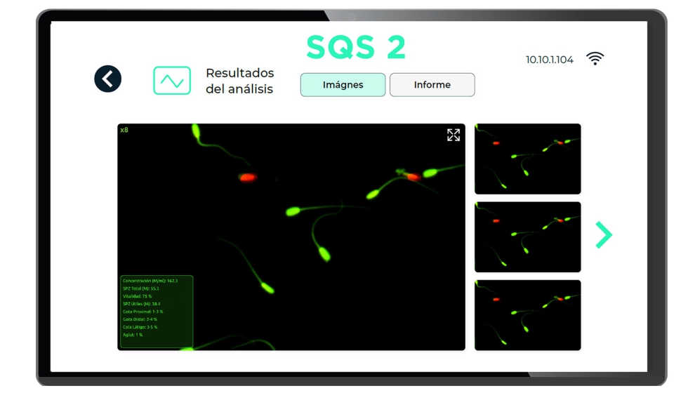 Software SQS2: analiza la vitalidad y concentracin del esperma en < 1 minuto