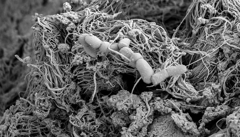 Imagem, obtida por microscopia eletrnica de varrimento, de um corte de carne onde se encontram clulas de Escherichia coli entero-hemorrgica...
