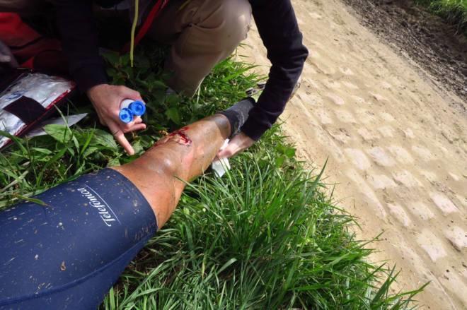 La pierna de Fran Ventoso durante su accidente en la Pars - Roubaix del 2016