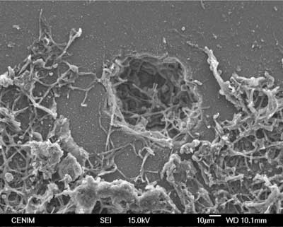 Micrografa de MEB de la superficie de un vidrio de la Cartuja de Miraflores (Burgos), mostrando un crter y filamentos producidos por biodeterioro...